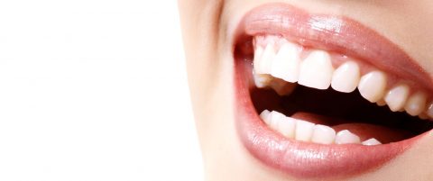 Types of Dental Veneers